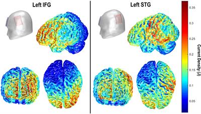 tDCS Facilitation of Picture Naming: Item-Specific, Task General, or Neither?